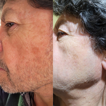 Renova Glow Colágeno