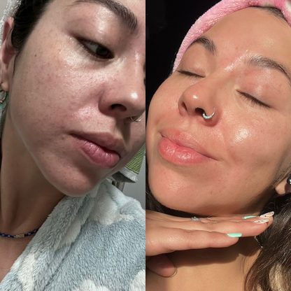 Renova Glow Colágeno